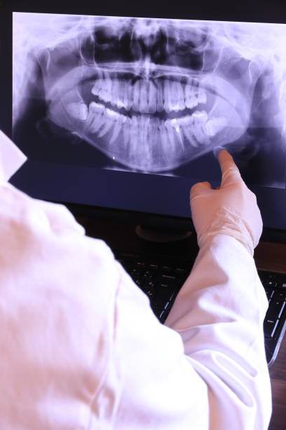 Best Urgent Tooth Repair  in Glendale, CA