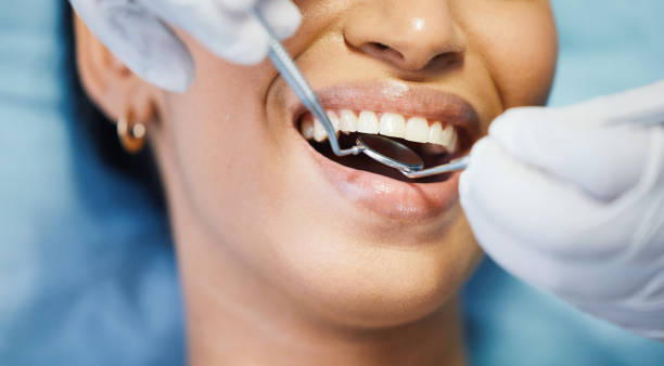 Best Chipped Tooth Repair Near Me  in Glendale, CA